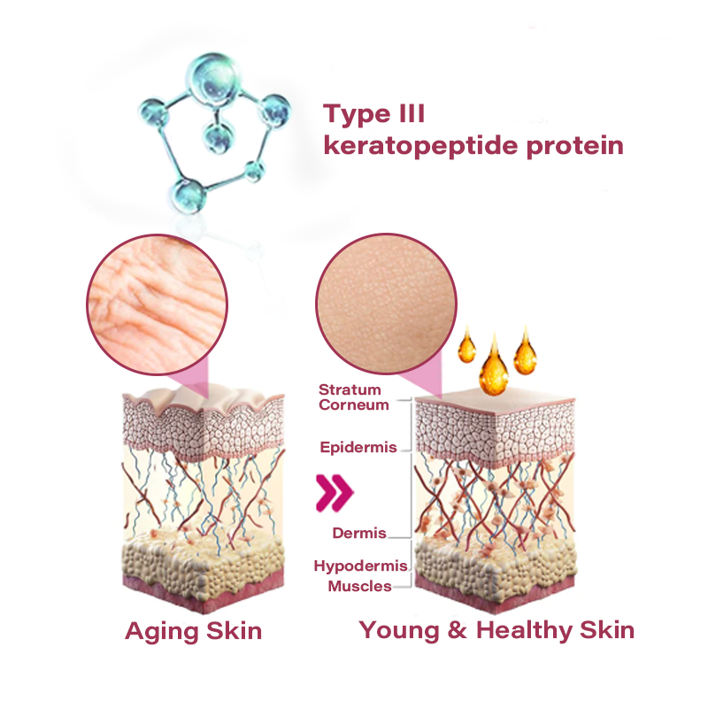 Sugoola™ Natural SizeUp Keratopeptide Protein Patch