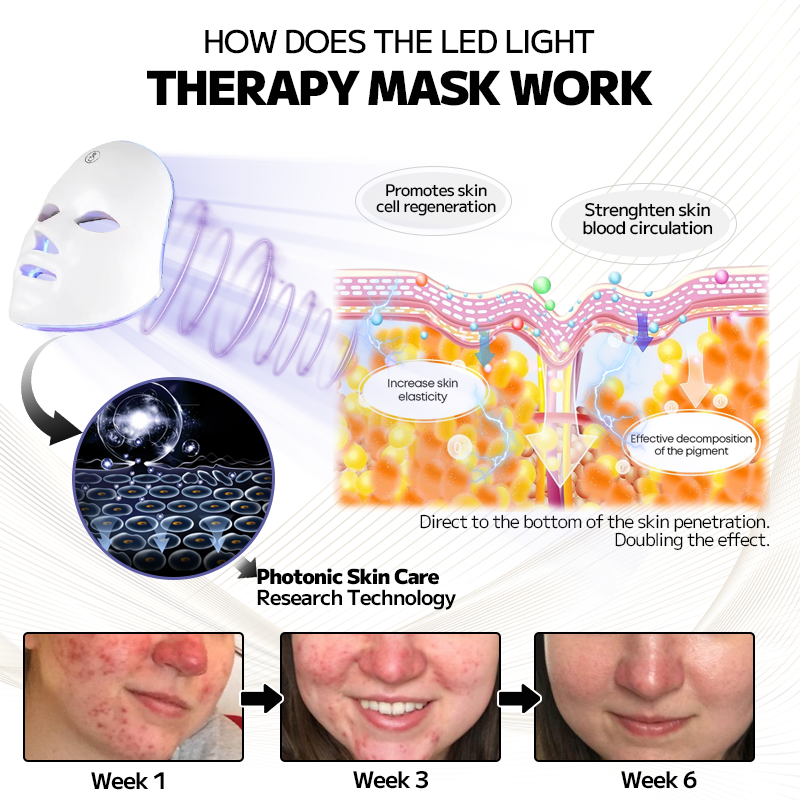 Ourlyard™ Laser Treatment Facial Mask for Rosacea