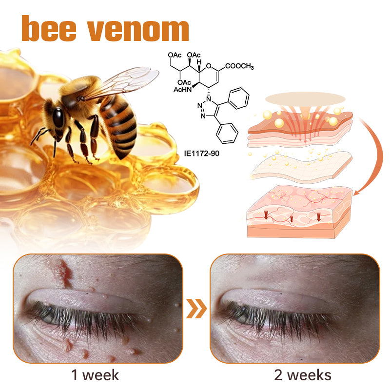 Ourlyard™ WartGone Bee Venom Treatment Patch