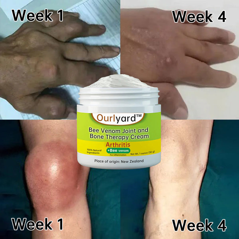 Ourlyard™ Bee Venom Joint and Bone Therapy Cream (Complete Body Recovery, Pure Natural Formula)
